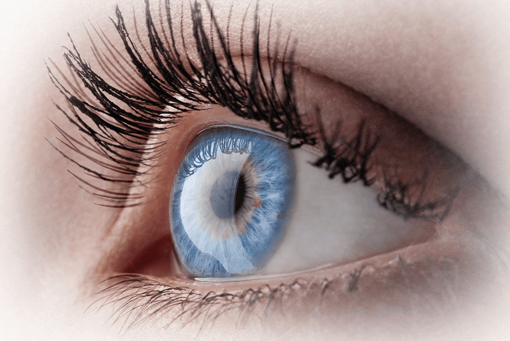 Lasik Story - Blue Eye Close Up
