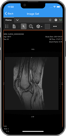 SurgiConnect app screen mri scan of leg